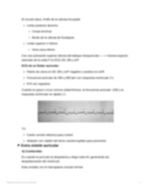 SOLUTION Trastornos Del Ritmo De La Conducci N Studypool