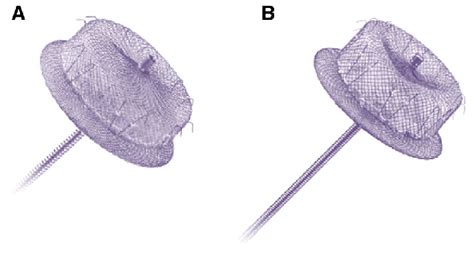 First And Second Generation Amplatzer Laa Occluders Cardiac Plug A