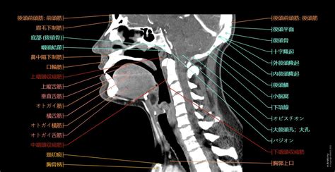 頭頚部 Ct 正常解剖学 E Anatomy