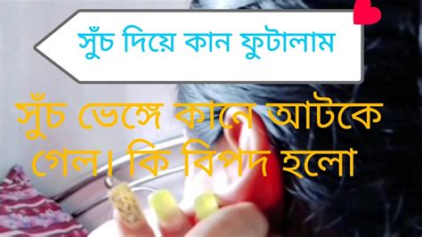 সখ পূরণ করতে গিয়ে বিপদে পরে গেলাম💥 সূঁচ দিয়ে কান ফুটাতে গিয়ে ভেঙ্গে