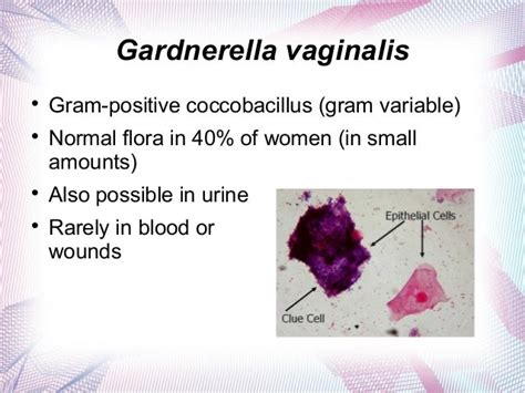 Sexton436presentation