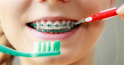 How To Maintain Oral Hygiene With Braces Dental Group Of Westchester