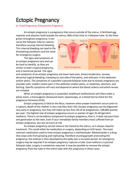 Ectopic Pregnancy Research Ectopic Pregnancy Ie Tubal Pregnancy