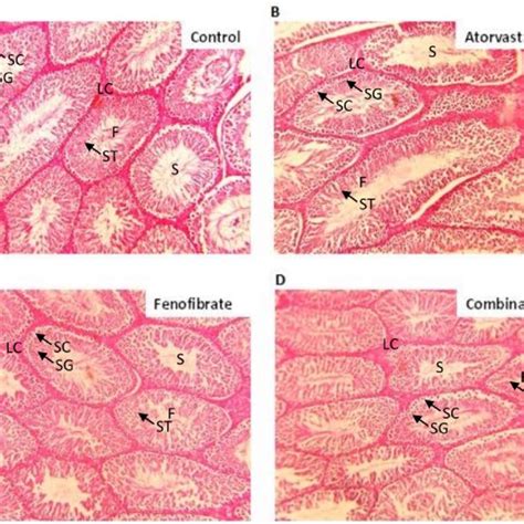 Histology Of Testis A Control Group Where B Atorvastatin 2 Mgkg