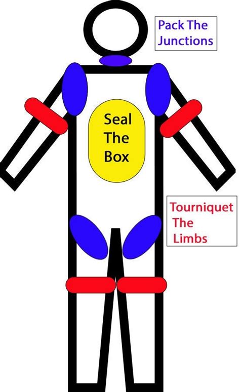 Tourniquet, Chest Seal, and Wound Packing Placement Infographic ...