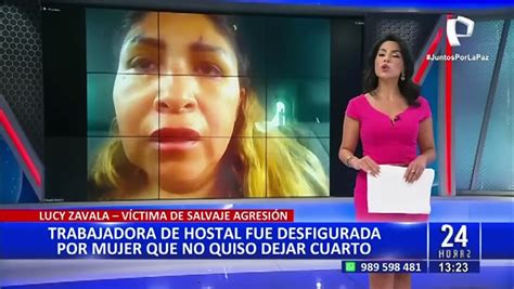 La desfiguran a días previos de su boda mujer agrede brutalmente a