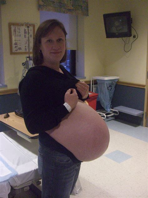 38 Weeks Pregnant With Twins The Maternity Gallery