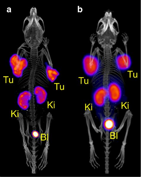 In Vivo SPECT CT Scan Of A Tumor Bearing Mouse 3 H After Injection Of