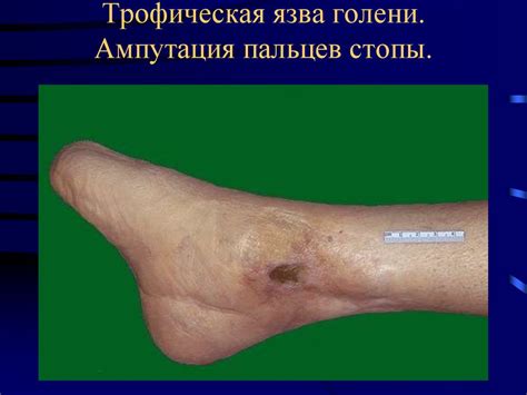 Нарушения кровообращения. Сложные патологические состояния ...