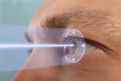 Benefits Of Lasik Laser Eye Surgery Neovision Eye Center