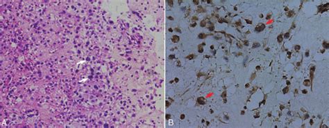 A Histologic Examination Hematoxylin And Eosin Staining Original