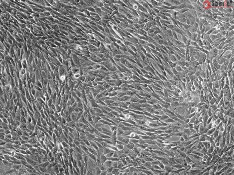 Human Skeletal Muscle Cells (HSkMC)