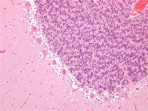 Cerebellum Histology Diagram | Quizlet