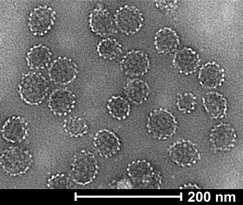 Recombinant Hpv Capsid L Protein Hpv Sino Biological