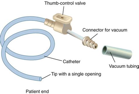 Airway Management Thoracic Key