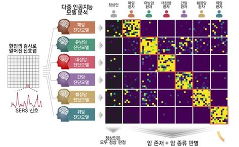 혈액 검사로 6대암 진단 가능97 정확도