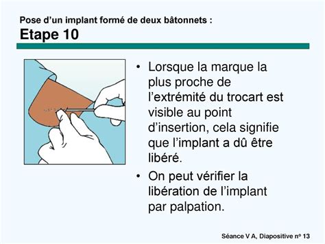 Implants contraceptifs ppt télécharger