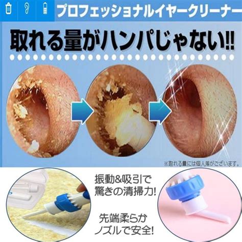 ゆうメール 送料無料 みみきれい 電動 耳かき イヤー クリーナー 収納ケース付き 洗浄 振動＆吸引式 耳垢吸引機 耳掃除 電池式 吸引