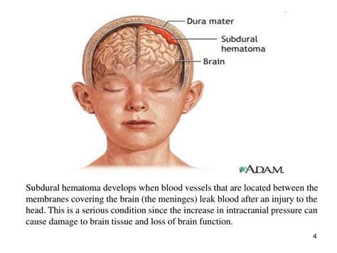 Ppt Increased Intracranial Pressure Icp Powerpoint Presentation