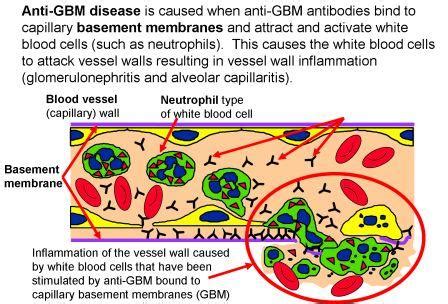 Is Thin Basement Membrane Disease Dangerous - Openbasement