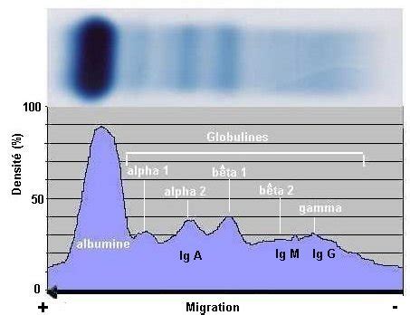 Electrophorèse de protéines immunologie