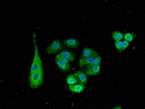 Anti SNX15 Antibody Rabbit Anti Human Polyclonal ELISA IF IHC LSBio