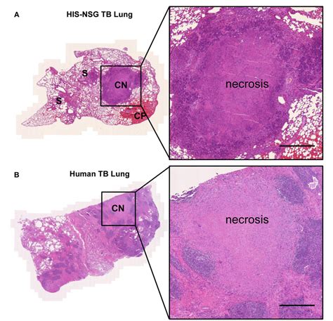 Figure 2 From Humanized Mouse Model Mimicking Pathology Of Human