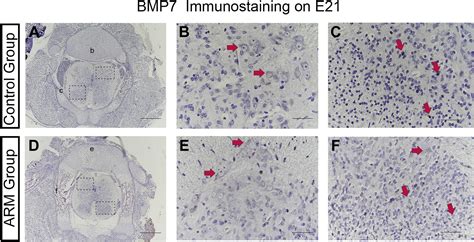 BMP7 Is Downregulated In Lumbosacral Spinal Cord Of Rat Embryos With