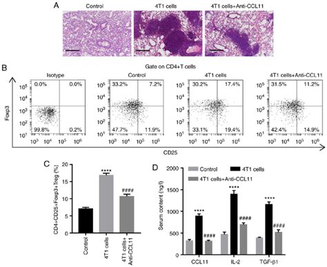 Ccl11 Blockade Inhibits The 4t1 Cell Induced Proportion Of Cd4 Cd25 Download Scientific