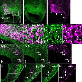 COUP-TFII protein is produced by the migrating neurons in the CMS. A–C ... 