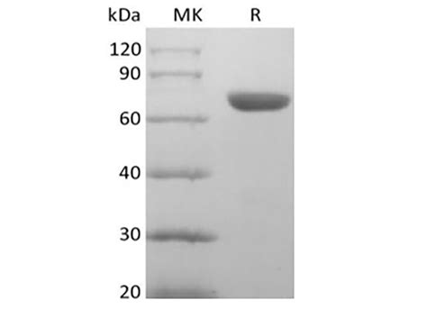 Recombinant Human EphA8 C 6His PKSH033977 Elabscience 官方网站