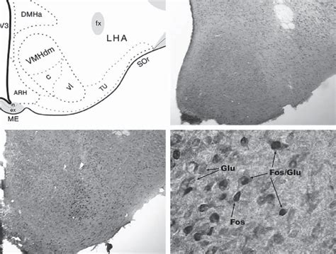 21 Activation Of Glutamate Neurons In The Vmh By 50 Artificial