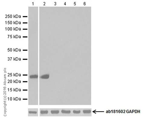 Recombinant Anti Prolactin PRL Antibody EPR19372 BSA And Azide Free