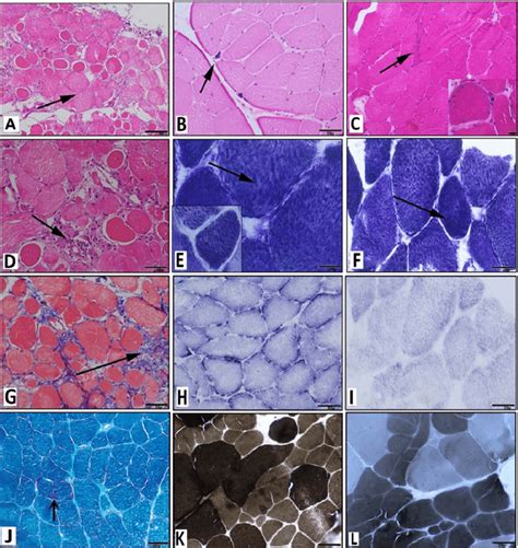 A Microphotograph Showing Transversely Sectioned Muscle Tissue With