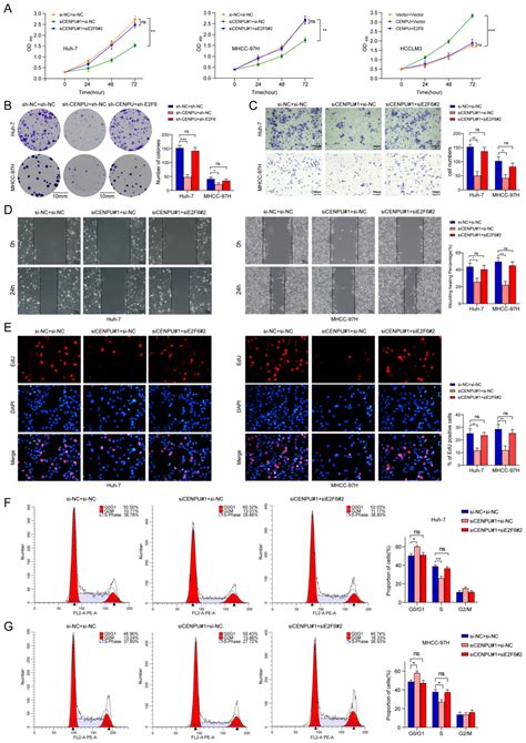 E2f6 Was Required For Cenpu Mediated Hcc Cell Growth Invasion