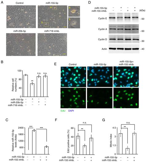 MicroRNA1555p Inhibits Trophoblast Cell Proliferation And Invasion By