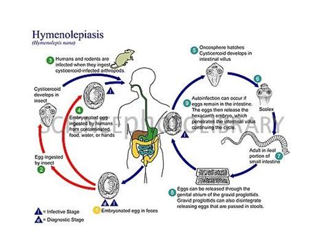 Pin on Infectious Diseases