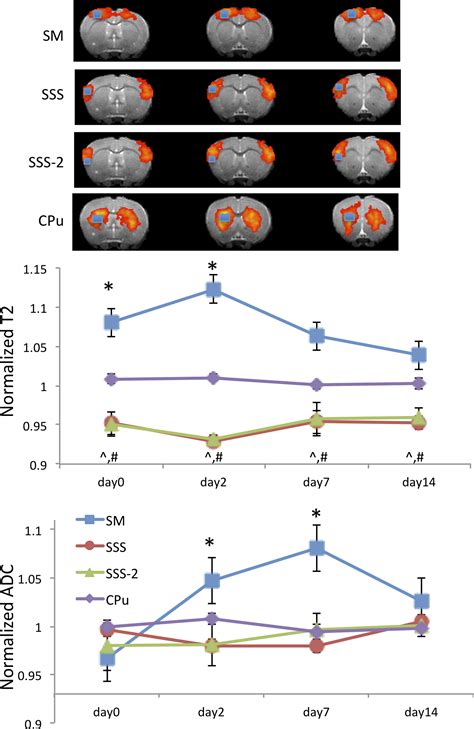 Resting State Functional Magnetic Resonance Imaging Of Interhemispheric