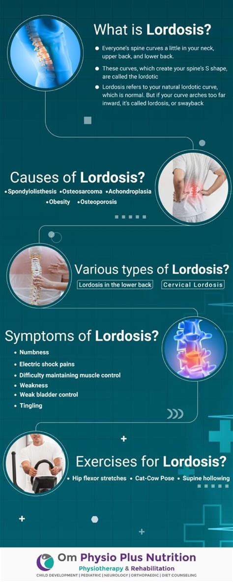 What Is Lordosis Causes Symptoms Treatments Types Of Lordosis