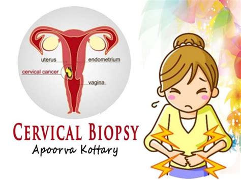 Cervical Biopsy Obstetrics And Gynaecology Ppt