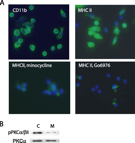 Minocycline Down Regulates MHC II Expression In Microglia And