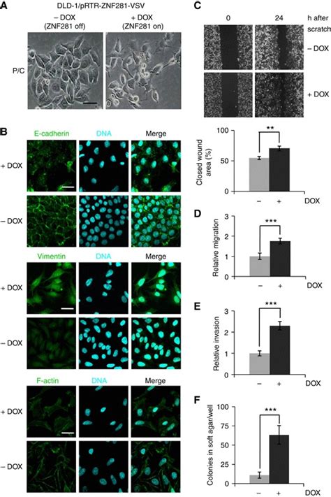 Ectopic Znf Induces Emt Migration And Invasion In Dld Cells