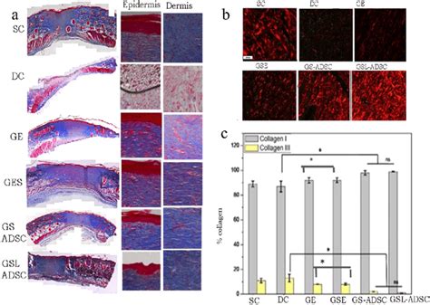 Masson S Trichrome And Picrosirius Red Staining A The Panel Shows Download Scientific