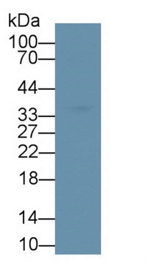 IL 1 beta Polyclonal Antibody Invitrogen 20 μL Unconjugated