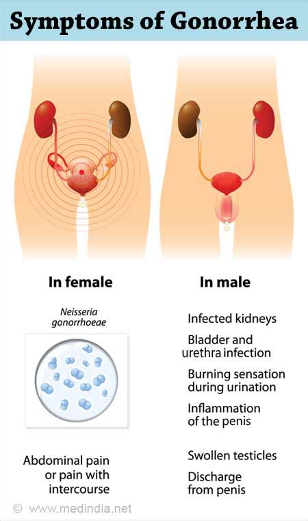 Gonorrhea Signs Symptoms And Complications 51 OFF