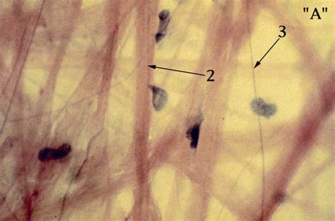 Connective Tissue Histology Flashcards Quizlet