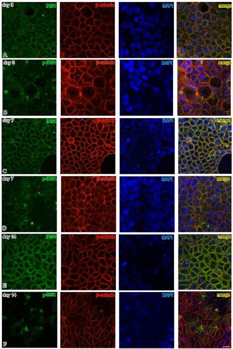 Subcellular localizations of IRS1 p IRS1 and ß catenin during Caco 2