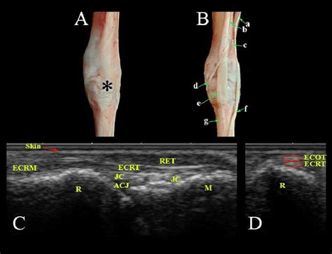 Dorsal Aspect Of The Carpal Region Photomacrographs A Superficial