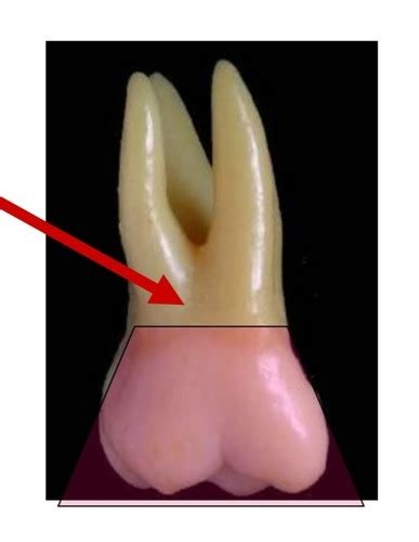 Point System Upper First Molar Flashcards Quizlet