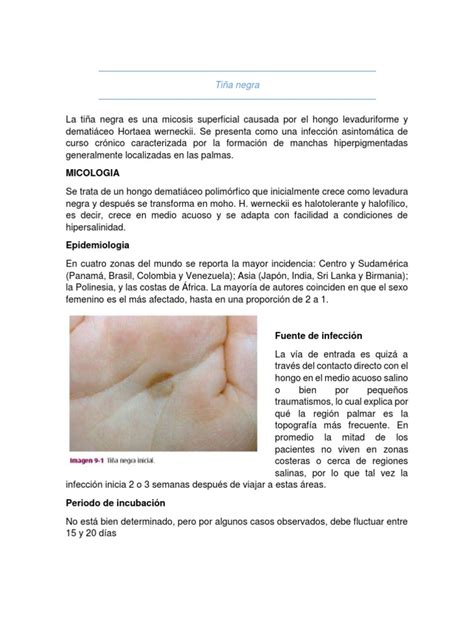 Dermatofitosis Una Revisión De Las Principales Micosis Superficiales Causadas Por Hongos Pdf